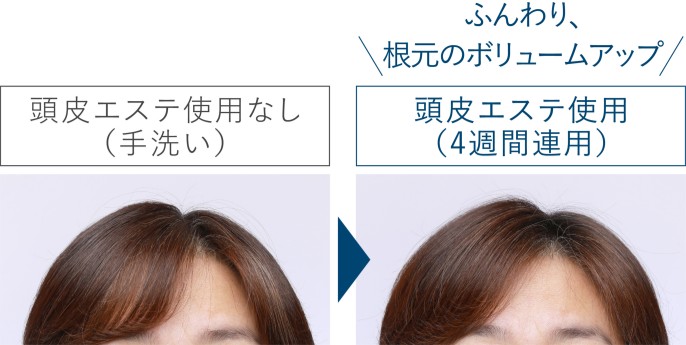 髪のボリュームアップ